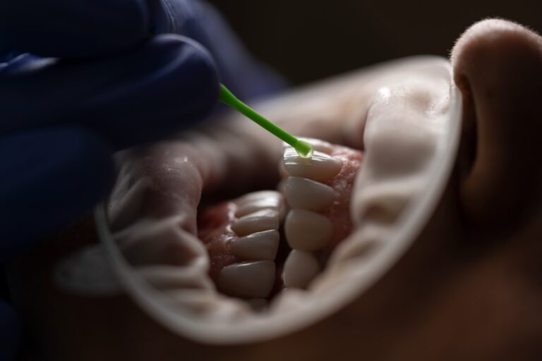 Zahnschiene reinigen: So bleibt sie hygienisch und klar